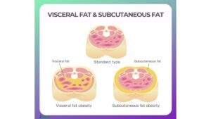 Visceral Fat and Subcutaneous Fat