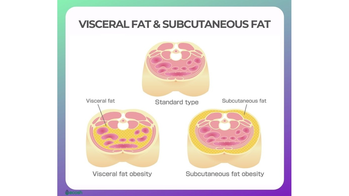 Visceral Fat and Subcutaneous Fat